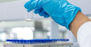 The Ultimate Guide to Liquid Chromatography: Your Questions Answered