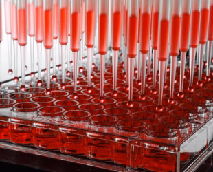 Analytik Jena Ireland - Laboratory Automation Solutions from Mason Technology