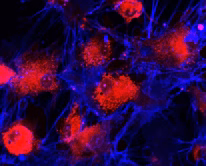 Secondary Antibodies
