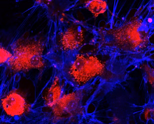 Secondary Antibodies
